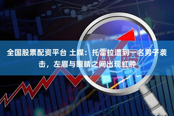 全国股票配资平台 土媒：托雷拉遭到一名男子袭击，左眉与眼睛之间出现红肿